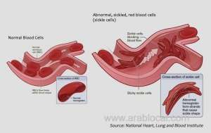 bahrain-set-for-new-drug-trial_bahrain