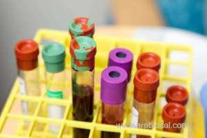 39-new-covid-19-cases-registered-in-bahrain-on-wednesday_bahrain